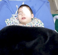 Syrian Refugee Boy Sponsored for Surgery in Lebanon