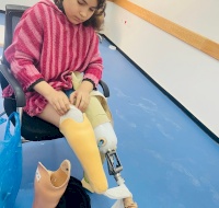 Amputee Program New Prosthesis