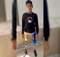Waseem Receives New Prostheses Through The Amputee Project