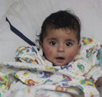 Syrian Child Sponsored for Surgery in Jordan