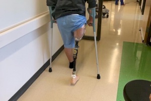 Injured Boy Gets New Leg in Portland
