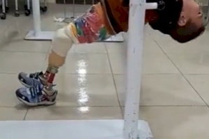 One-Time-Sponsorship Prosthesis