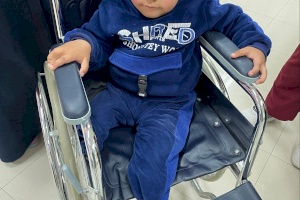 Two Amputee Children Receive Rehabilitation And Prosthesis Treatment