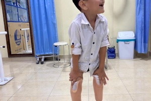 One-Time-Sponsorship Program Beneficiary Receives New Limbs