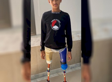 Waseem Receives New Prostheses Through The Amputee Project