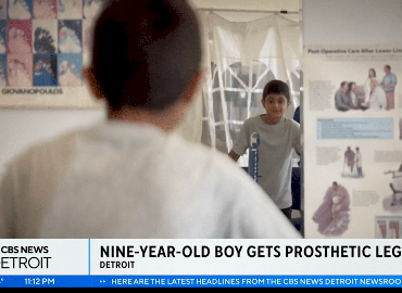 Young boy from Palestine receives life-changing prosthetic in Detroit
