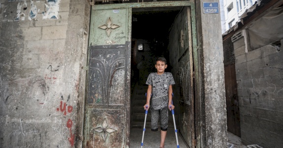 SANAD: Children's Amputee Program