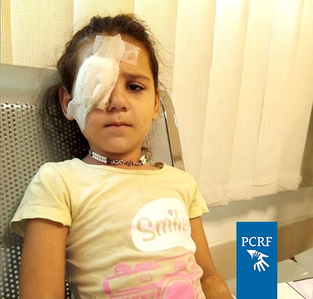 Syrian Girl Has Eye Surgery in Lebanon