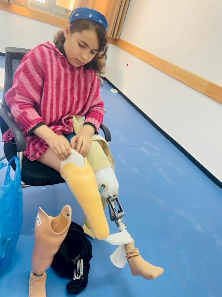 Amputee Program New Prosthesis