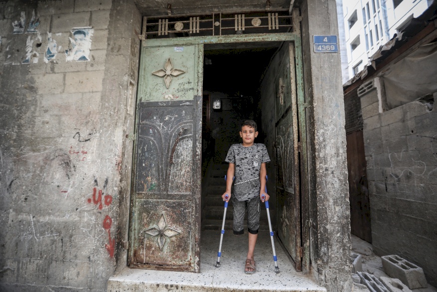 SANAD: Children's Amputee Program