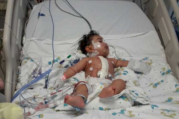 Baby Has Urgent Life-saving Surgery in Lebanon