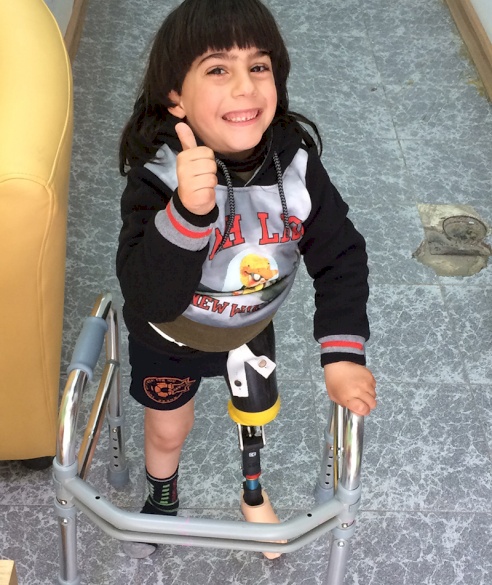 PCRF Sponsors Amputee For New Leg in Palestine
