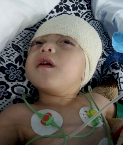 Syrian Baby Sponsored For Neurosurgery in Jordan