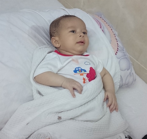 Syrian Baby Sponsored for Surgery in Jordan