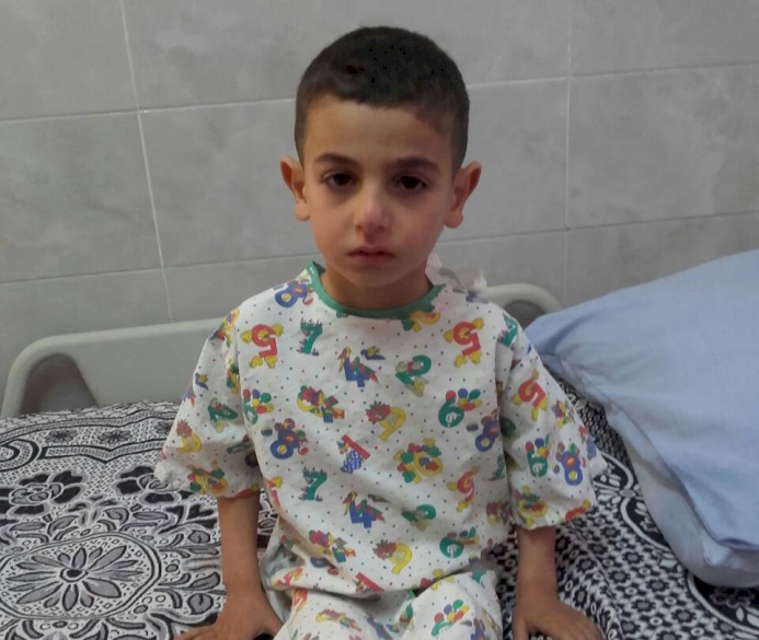 Syrian Refugee Sponsored for Surgery in Jordan