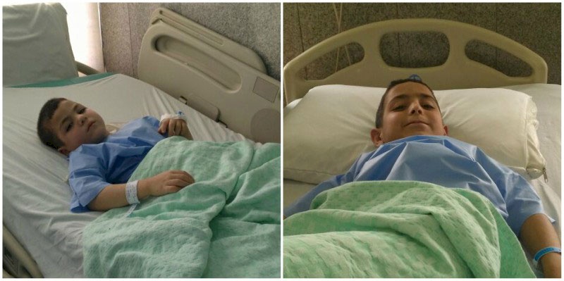 Syrian Brothers Sponsored for Surgery in Jordan
