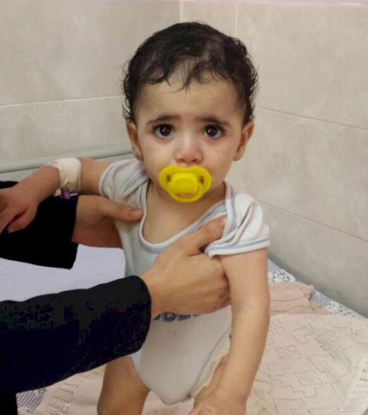 Syrian Child Sponsored for Surgery