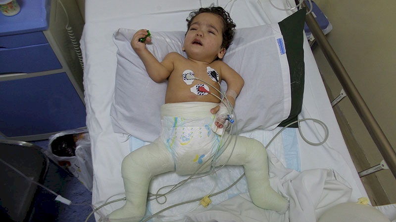Palestinian Child Sponsored for Surgery in Jordan