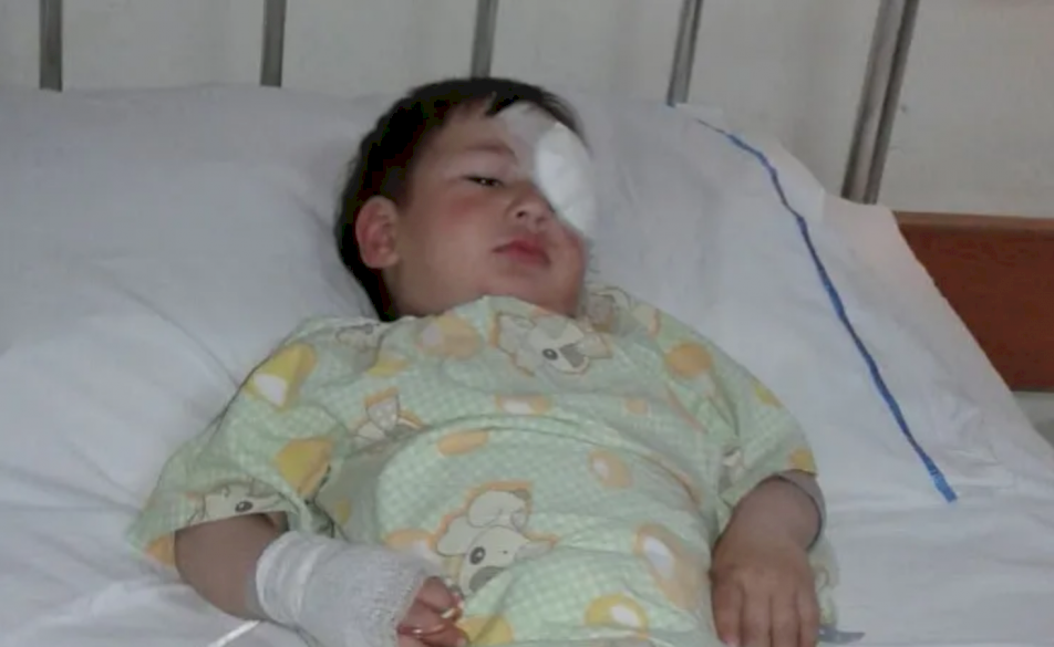 Syrian Refugee Has Surgery to Remove Tumor
